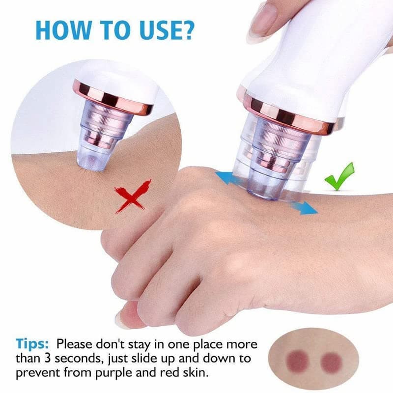 ⭐ DermaGlow 5-in-1 Blackhead Vacuum Pore Cleaner